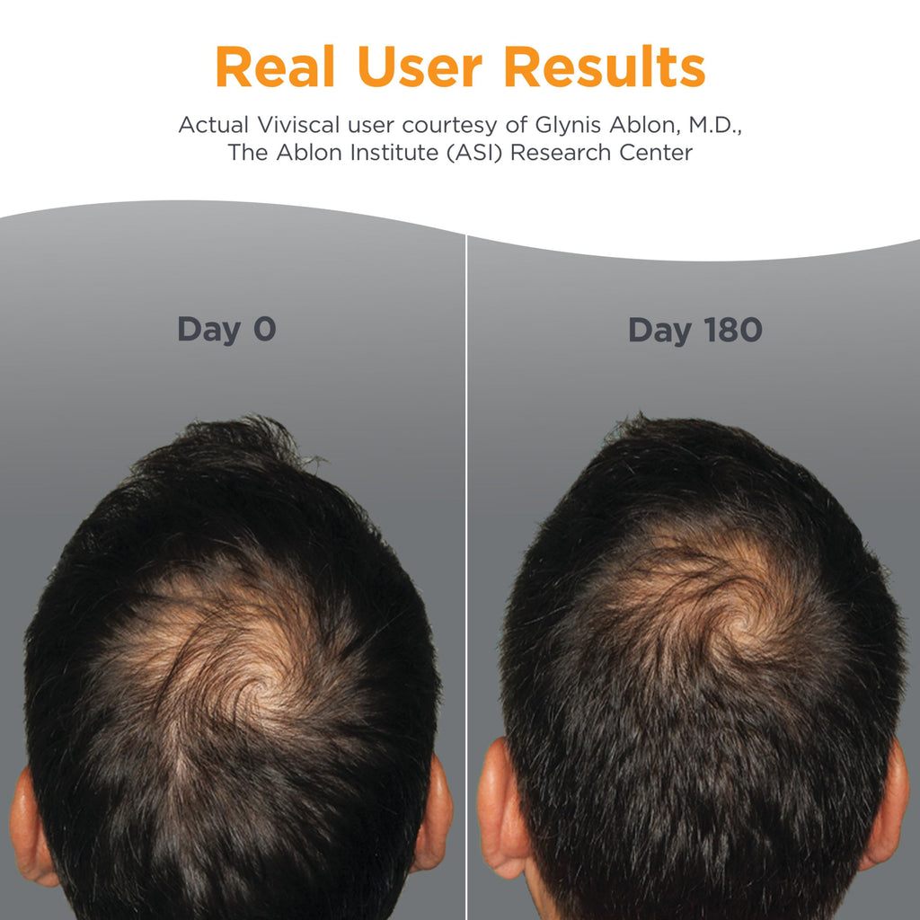 Men's Hair Growth Supplements 180 Tablets S4651