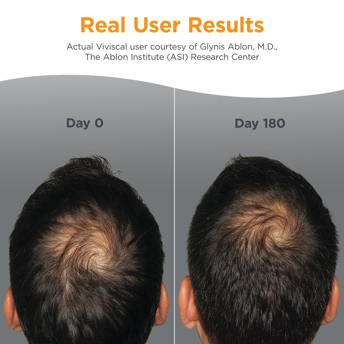 Men's Hair Growth Supplements 180 Tablets S4651